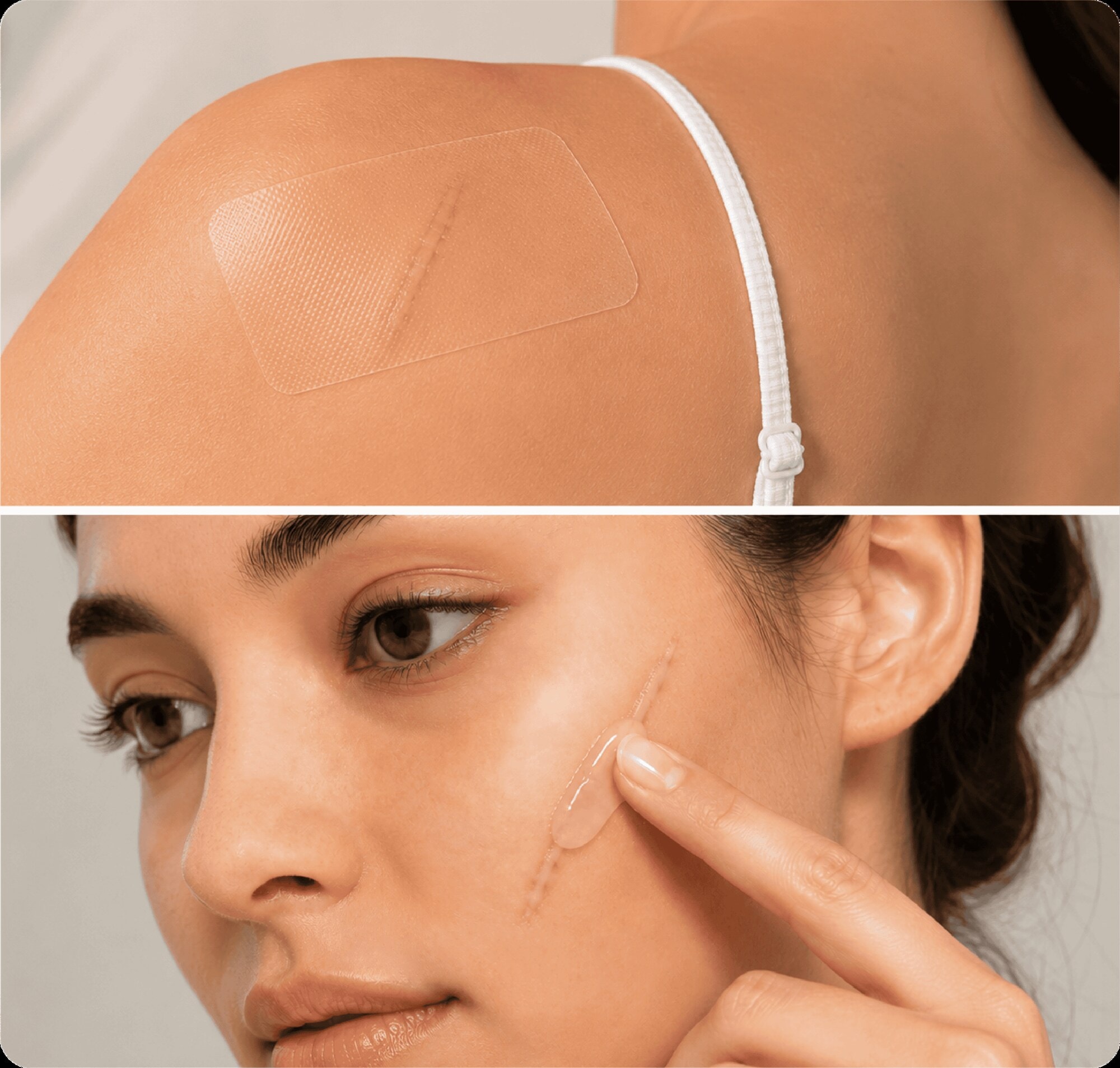Scar sheet under clothing and gel on cheek